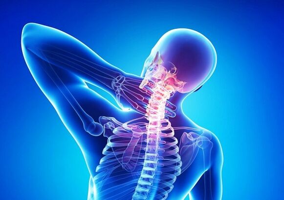 bolečine v vratni hrbtenici z osteohondrozo