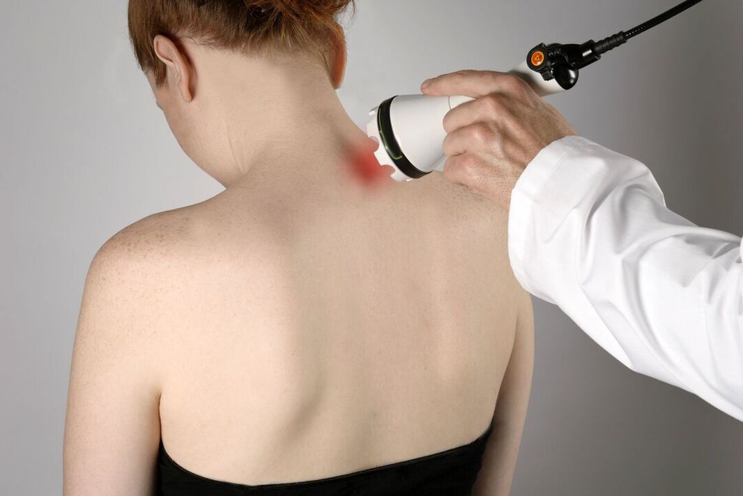 fizioterapevtsko zdravljenje cervikalne osteohondroze