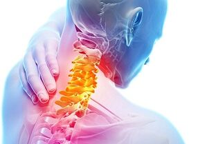 Glavni znaki in simptomi osteohondroze materničnega vratu